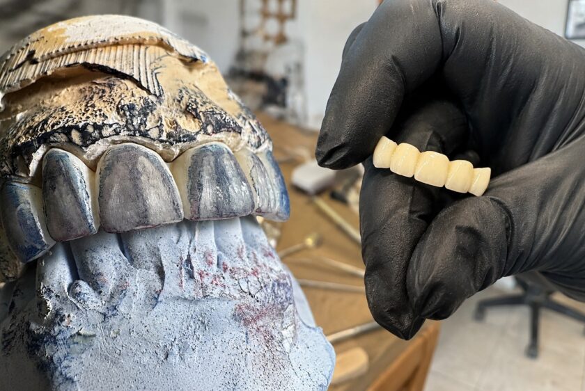 Prelucrarea Zirconiului după Sinterizare _ ToothLife