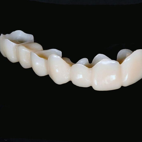 PMMA de Lunga Durata – Lucrari Dentare _ ToothLife 111