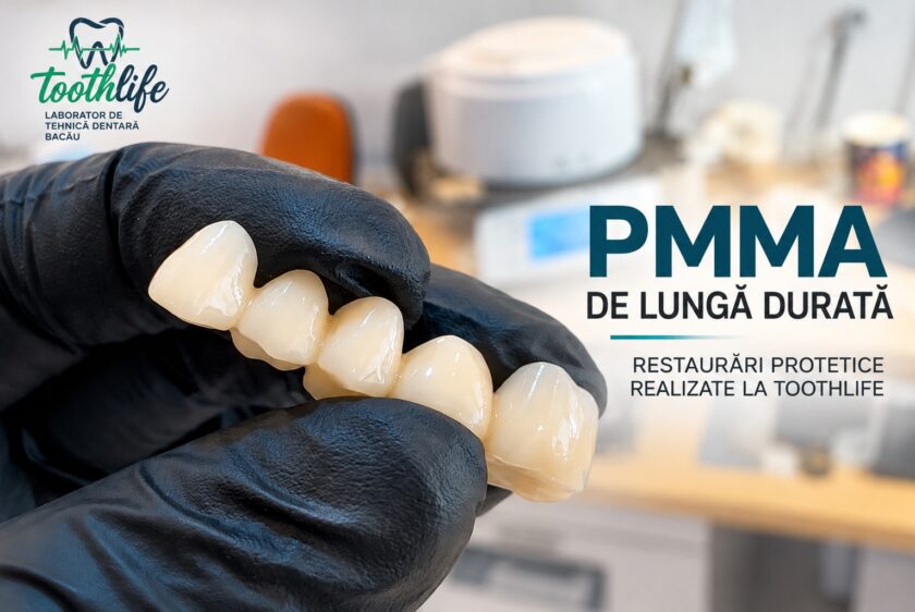 PMMA de Lunga Durata – Lucrari Dentare _ ToothLife 1111