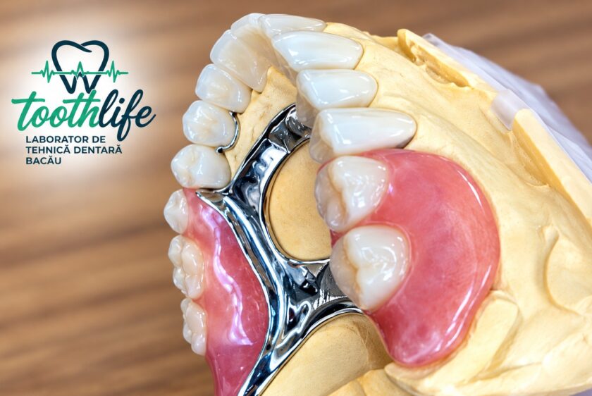 Proteză Scheletată cu Sisteme Speciale ToothLife